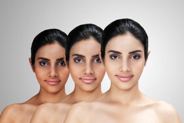 Types of Skin Whitening Treatments