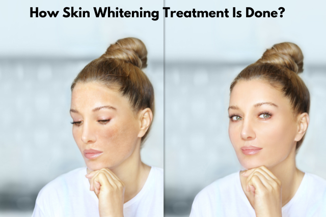 How Skin Whitening Treatment Is Done